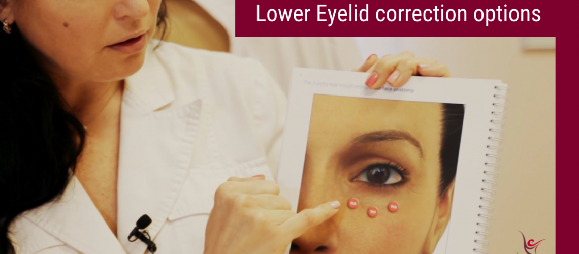 Lower Eyelid correction options