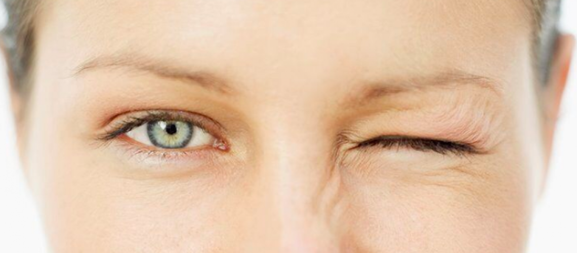 Plakstiņu korekcija