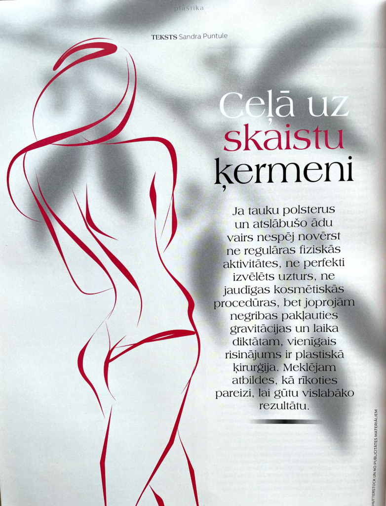Perle1 1