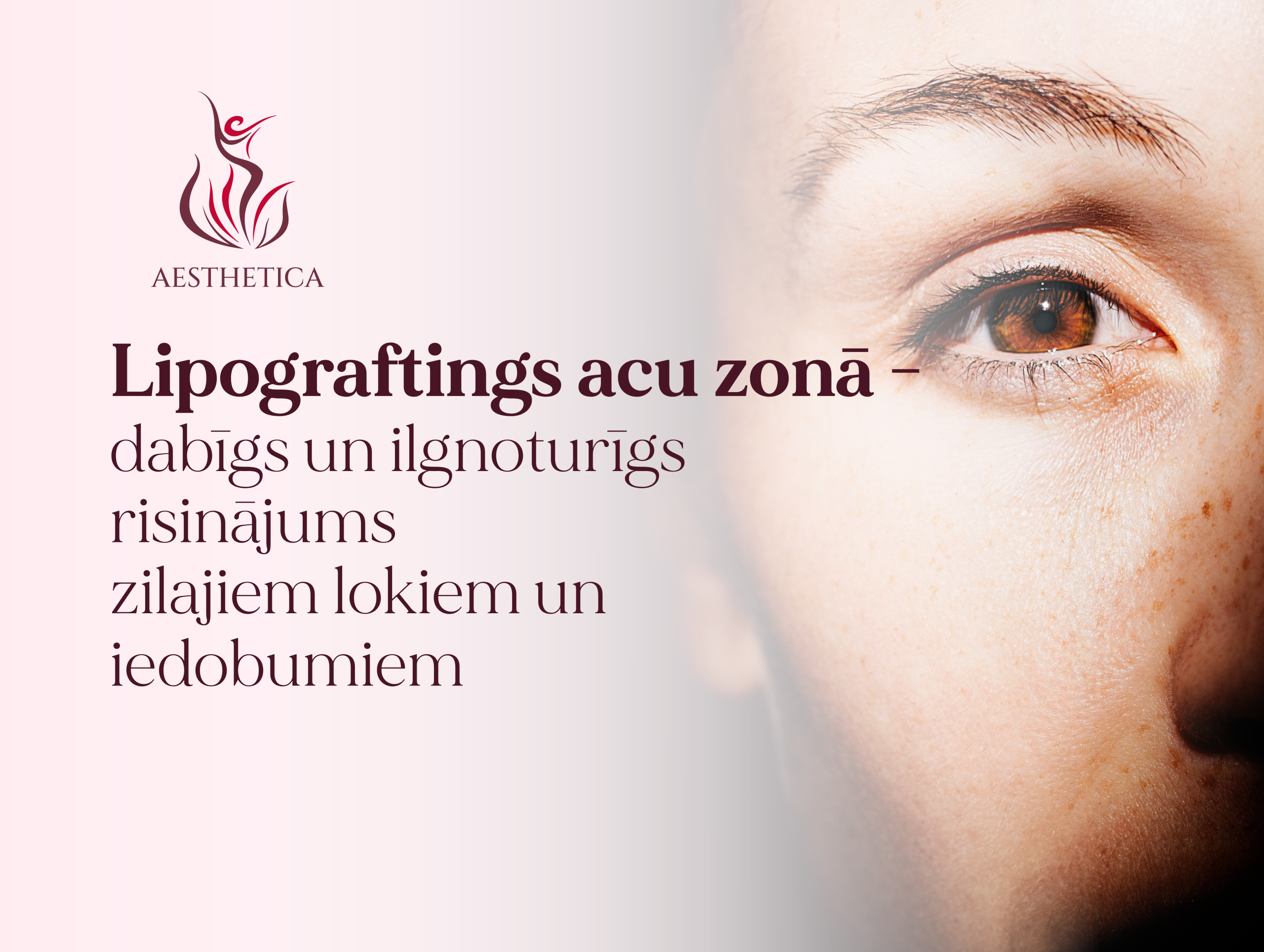 MĀjas Lapas Rakstiem 10